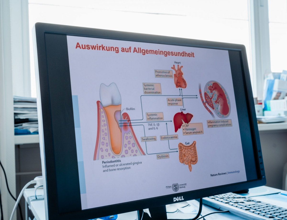 Eine zahnmedizinische Grafik auf einem Bildschirm im zahnmedizinischen Labor der Philipps-Universität Marburg.