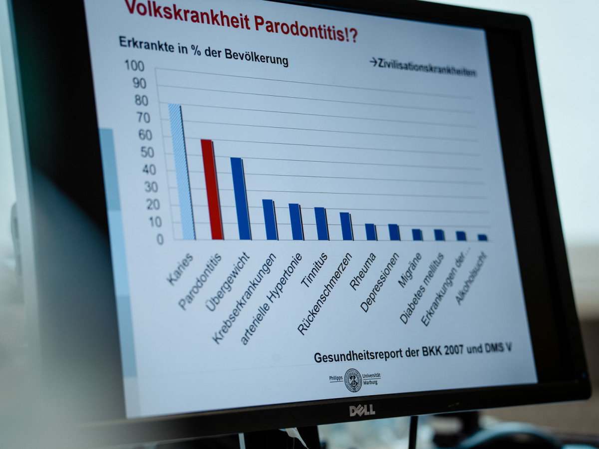 Unter Parodontitis hingegen leiden bis zu 70 % der Bevölkerung – eine echte Volkskrankheit!