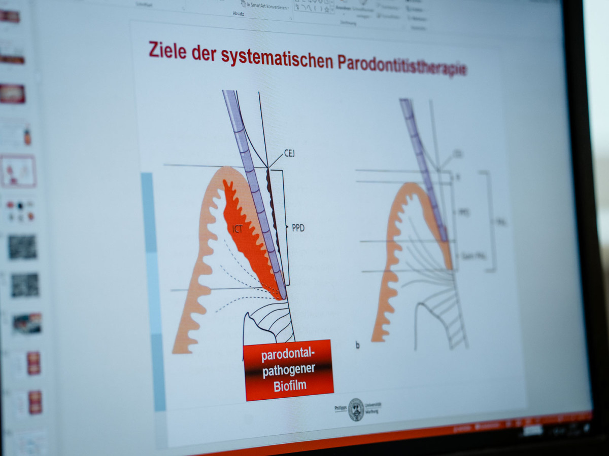 Der Forschungsschwerpunkt liegt auf dem Krankheitsbild der Parodontitis, einer chronischen Entzündung des Zahnfleisches, die auch den Knochen befallen und im schlimmsten Fall zum Zahnausfall führen kann.