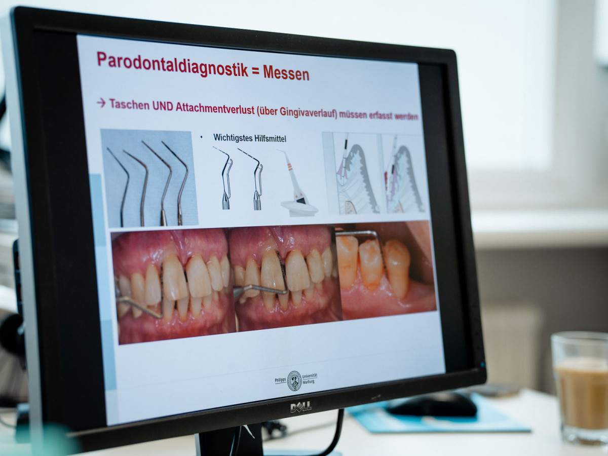 Zu Gast bei Frau Prof. Arweiler in der Parodontologie an der Philipps-Universität Marburg